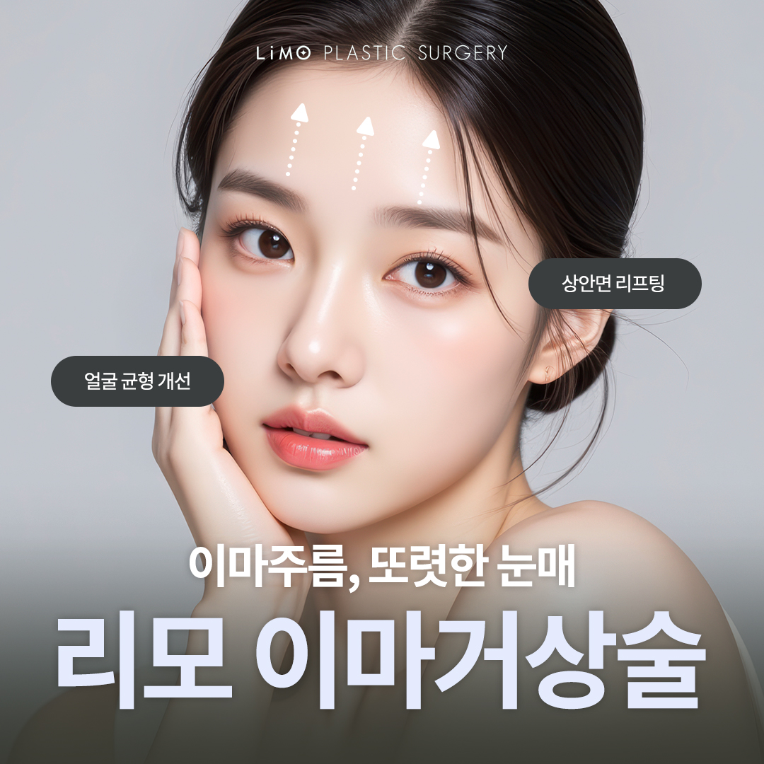 춘천테스트울쎄라 이벤트 카드 1